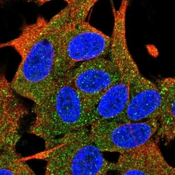 PAC1R Antibody, Novus Biologicals 0.1mL; Unlabeled:Antibodies, Polyclonal